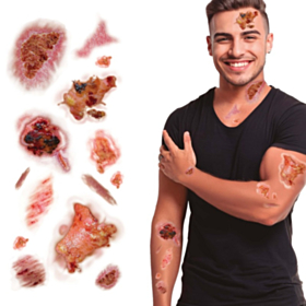 Inficerede Sår Falske Tatoveringer