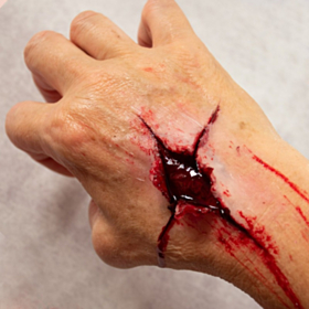 Sår Voks Komplet Sæt