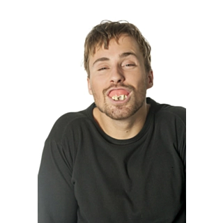 Rådne tænder